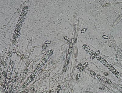 Peziza echinospora sporen