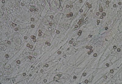 Sporen Entoloma sericeum var. sericeum 400 X 7½-8 µm