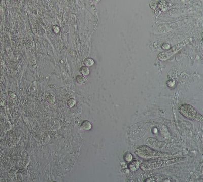 Sporen gr. sl. Amaniet 10 X 12 µm