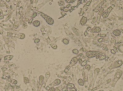 Spitse wasplaat sporen en cystiden, Hygrocybe subglobispora