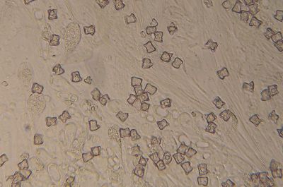 Sterspoorsatijnzwammetje, sporen 5-6½ µm Entoloma conferendum var. pusillum