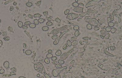 Gebochelde wasplaat sporen