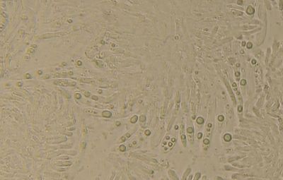 Ascomyceet spec. sporen 1-2½ µm