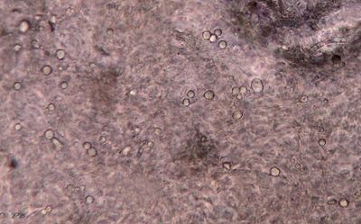 Galery Amaniten en Knolamanieten