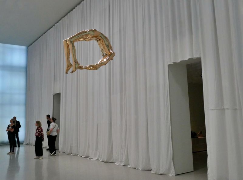 Arch of hysteria