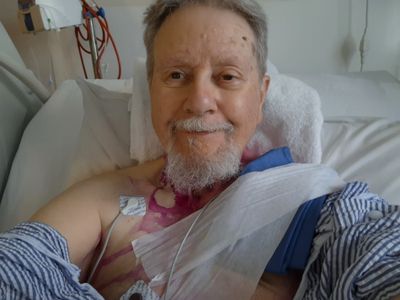 025.jpg Post op and back in the ward.....wires everywhere.
