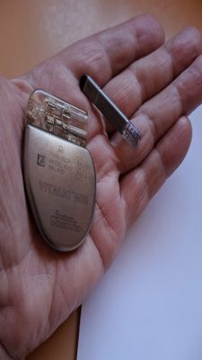 PACEMAKER REPLACEMENT 09-04-25