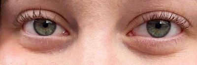 The eyes have it