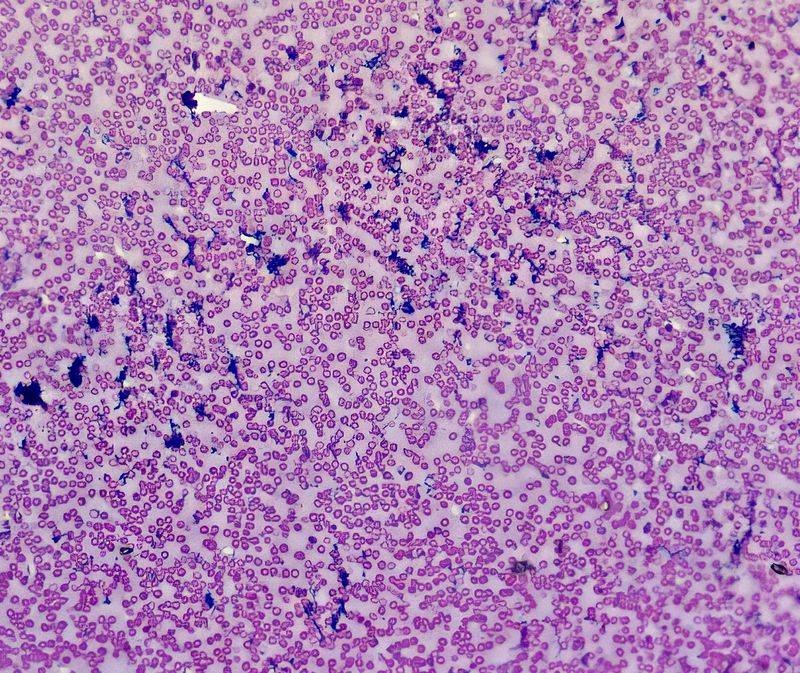 Human Blood smear