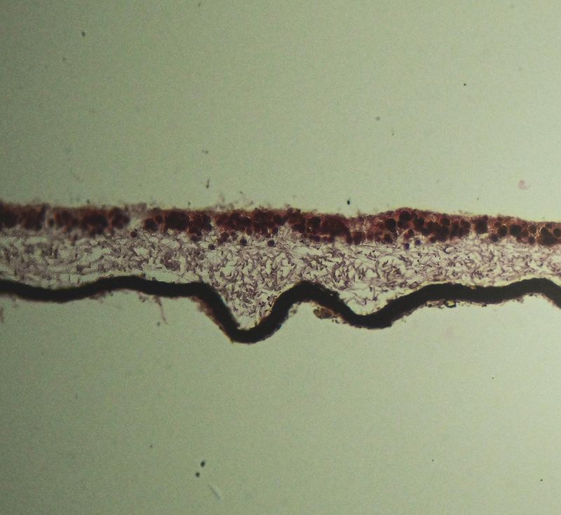 Foliose Lichen section