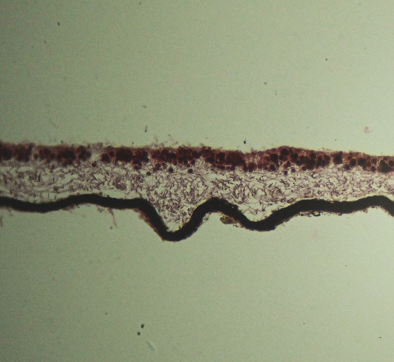 Foliose Lichen section  showing algal and fungal cells
