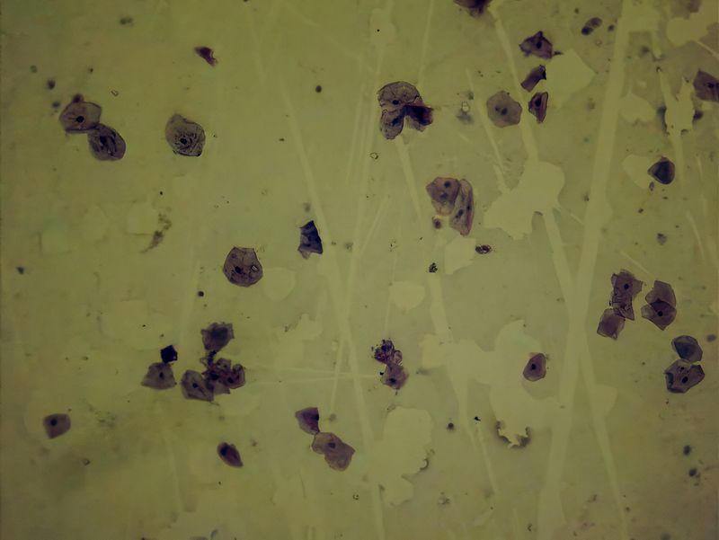 Bacteria from your mouth