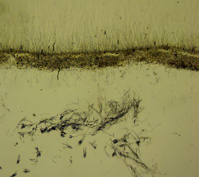 Penicillium -cheese fungus-
