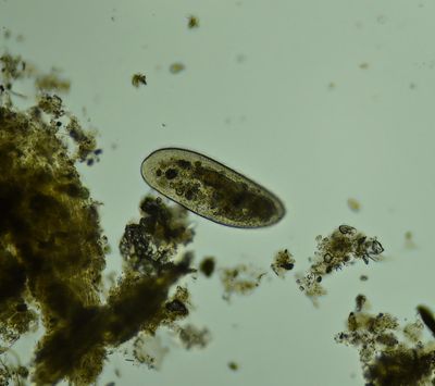 Paramecium -fresh water protozoa-