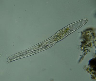 Flatworm -Platyhelminthes-