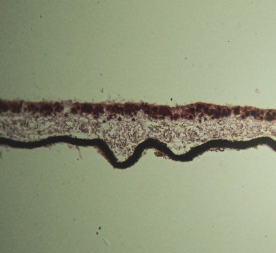Foliose Lichen section