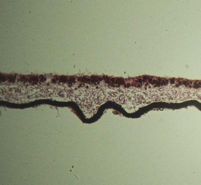 Foliose Lichen section  showing algal and fungal cells