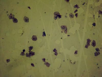 Bacteria from your mouth