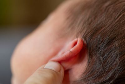 VanCampen ear genetics