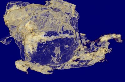 Vampyronassa micro CT image showing beaks