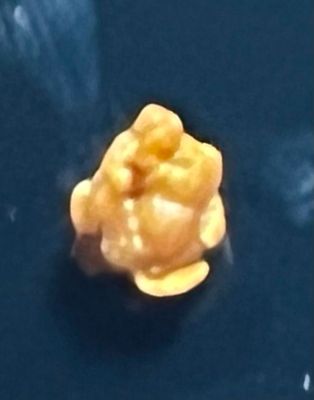 kidney_stone