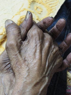Hands
