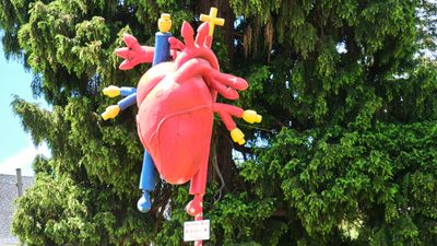 Open Heart
