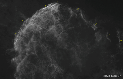 Supernova Remnant IC 443 -- 70 years