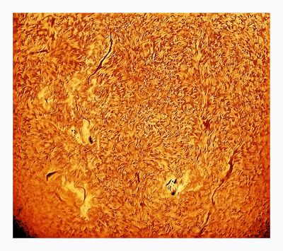 Solar surface