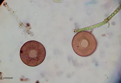  Schaalamoebe (Arcella sp).JPG