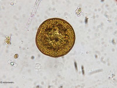 Schaalamoebe - (Arcella sp).JPG