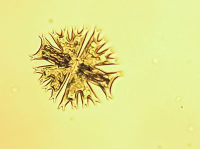 Protist-splanton-weeds