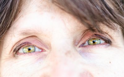 05 The (Green) Eyes Have It