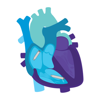 AVEIRDR_Heart_DR.png
