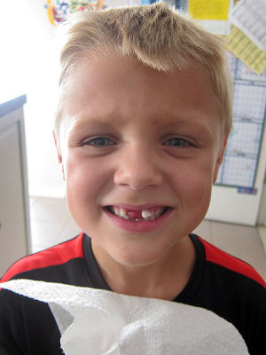 Another tooth has gone missing!