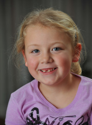 Macey with her missing front tooth