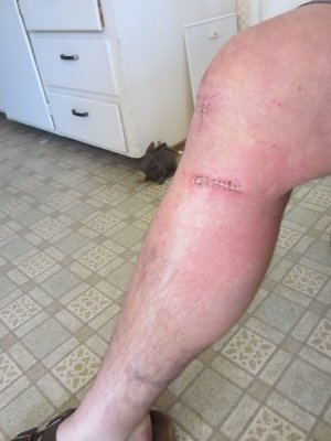 ACL 012.jpg