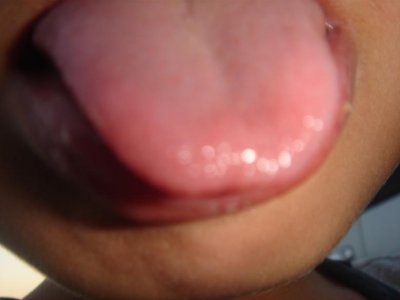  Javian's Tongue