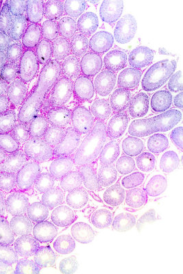 Testis-ts-spermatogenesis.jpg