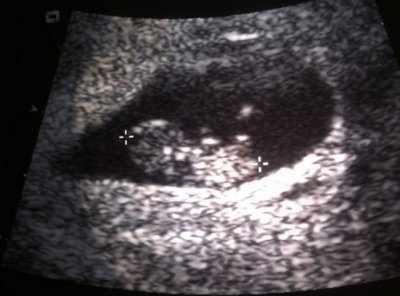Baby's kickin'!
