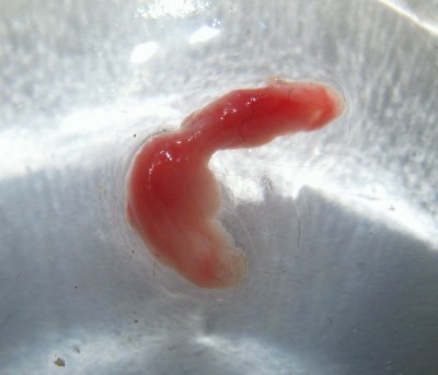 Passed 1.3 cm long artifact from my Old Cat's bladder 4/27/13