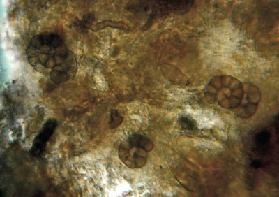 Cirrenalia lignicola (Hyphomycete) on rotten wood x400 showing conidiospores CarltonWood Jan-11 HW