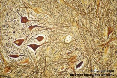 g3/02/469602/3/58803785.SpinalCord.jpg
