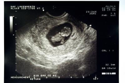 2006Feb22.jpg