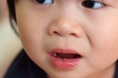 the dreaded Hand-foot-mouth disease