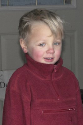 Rosy cheeks