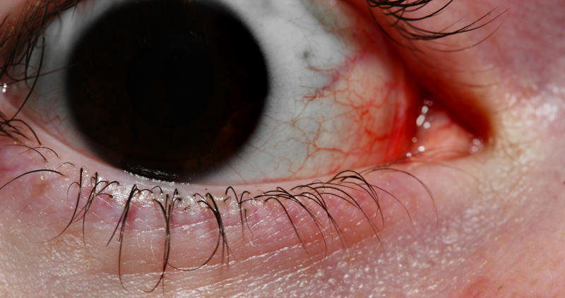 eye