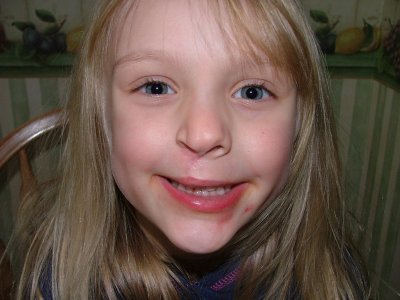 Hey all welcome to my 5 to 10 yr cleft site. If you want to see my 0-5 years click here  http://www.pbase.com/stella97king/cleft_lip