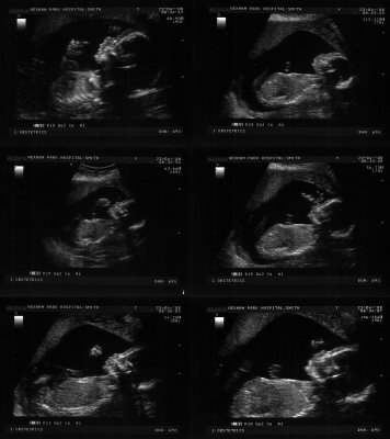 All Edwards Scan photos