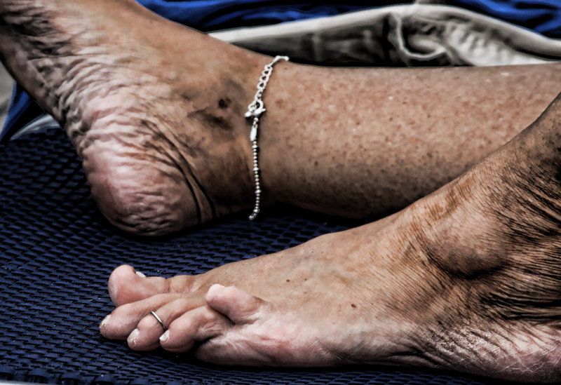 GNARLY - GNARLY FEET AND TOE